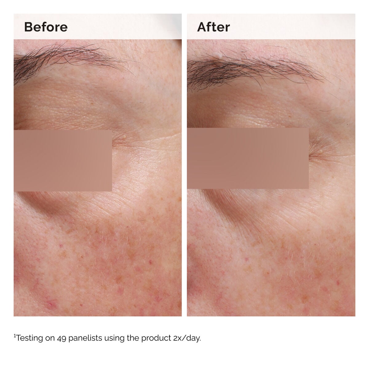 niacinamide-5-face-and-body-emulsion-m6 2024-08-23-ORD-Nia-5pct-Face-Body-B-A-Elasticity-Global-02-1x1.jpg