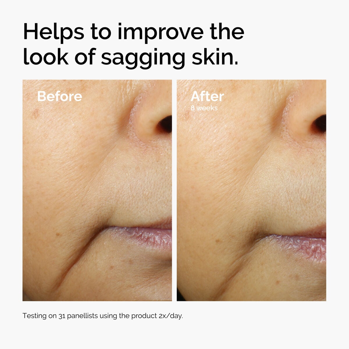 caffeine-3-escin-1-face-serum-g4 ord-caffeine-3pct-escin-1pct-face-serum-before-after-sagging.jpg