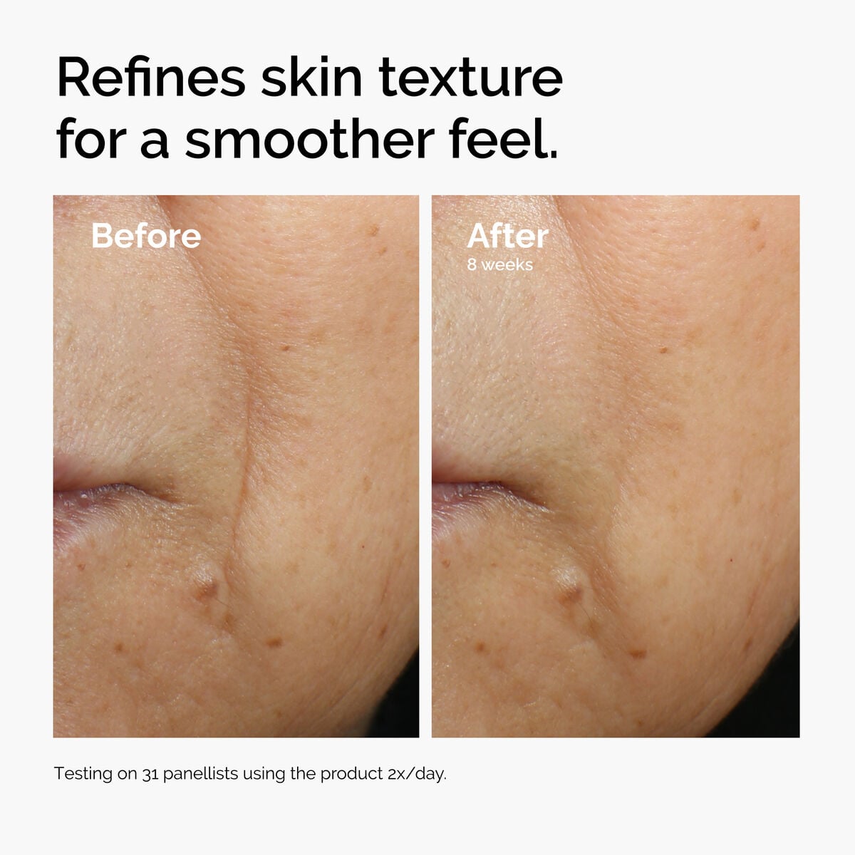 caffeine-3-escin-1-face-serum-g4 ord-caffeine-3pct-escin-1pct-face-serum-before-after-texture.jpg