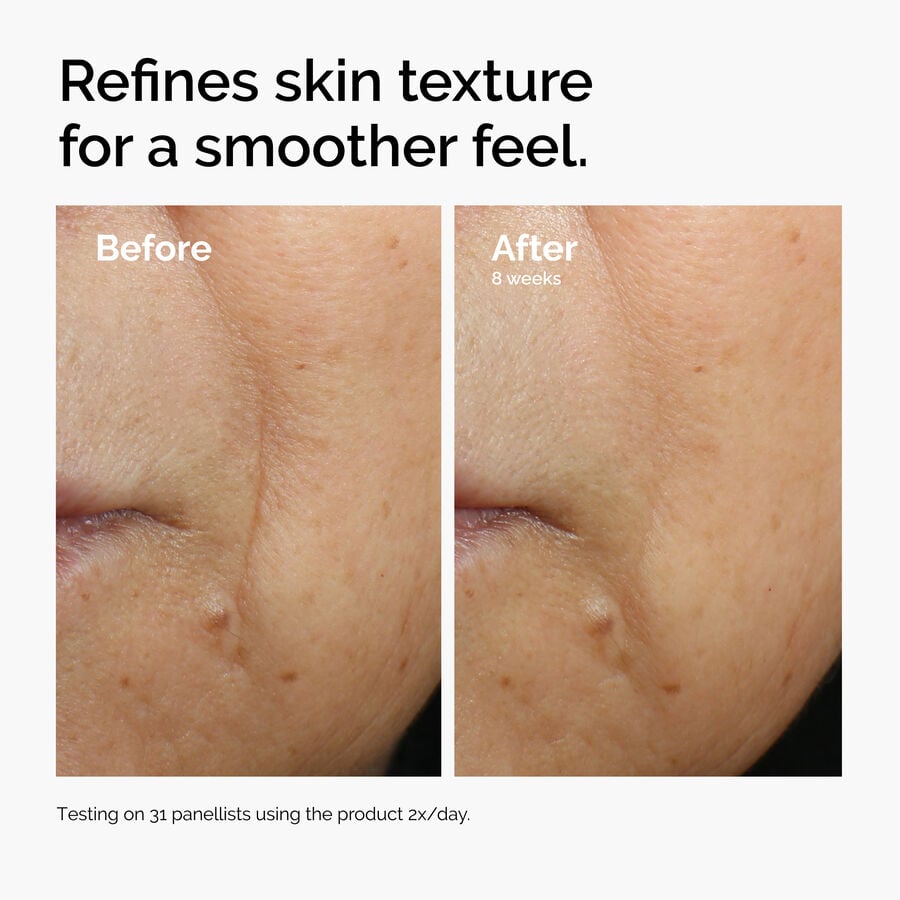 caffeine-3-escin-1-face-serum-a4 ord-caffeine-3pct-escin-1pct-face-serum-before-after-texture.jpg