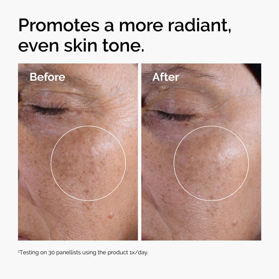 glycolic-acid-7-exfoliating-toner-q2 ord-glycolic-before-after-radiance.jpg