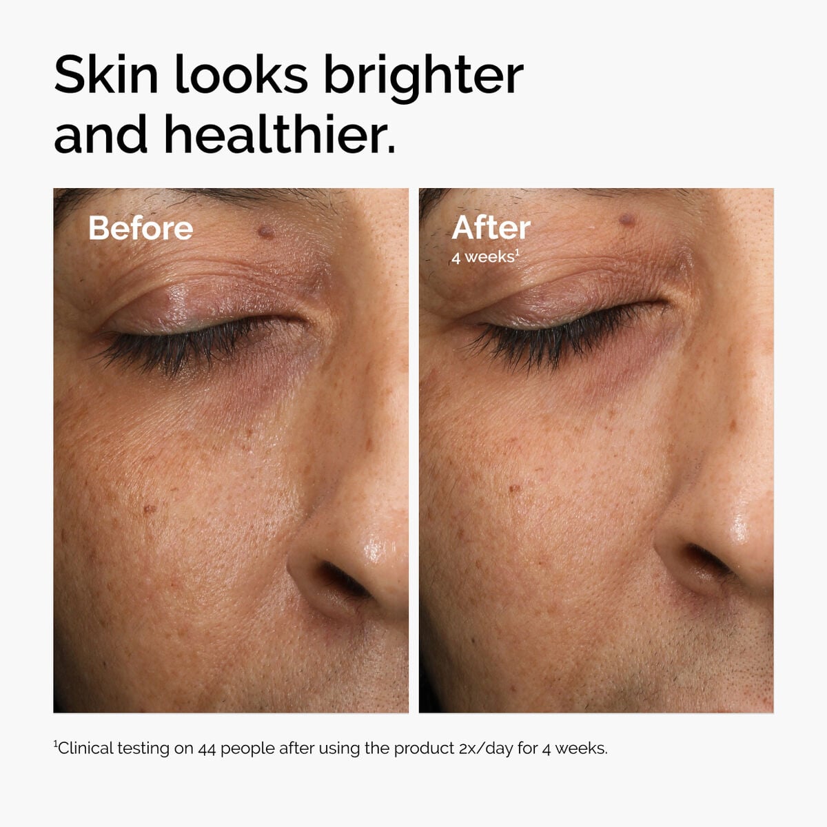 multi-antioxidant-radiance-serum-n9 ord-mars-before-after-healthy.jpg
