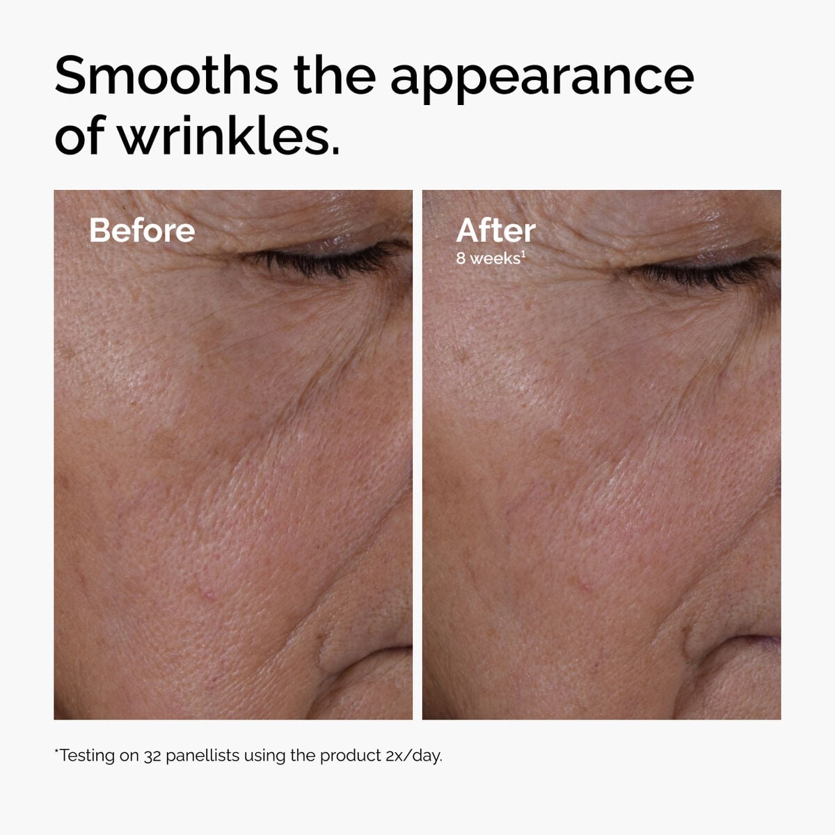 multi-peptide-ha-serum-l3 ord-multi-peptide-ha-serum-wrinkles-before-after.jpg