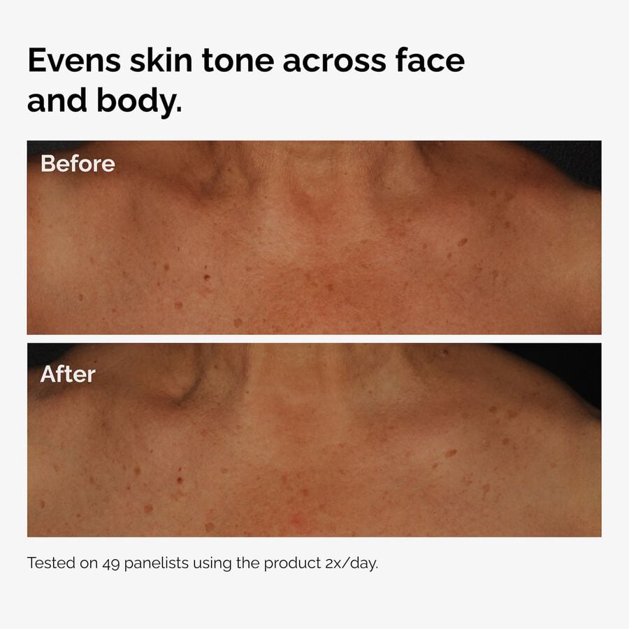 the-body-care-collection-t9 ord-niacinamide-face-body-serum-before-after-even-tone-graphic.jpg