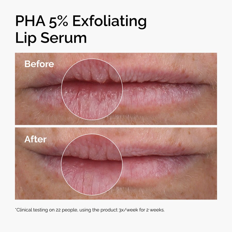 pha-5-exfoliating-lip-serum-s7 ord-pha-5pct-lip-exfoliating-serum-before-after.jpg